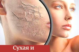 Причины сухой кожи тела у женщин и лечение
